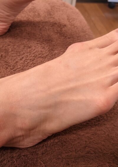（施術前写真）